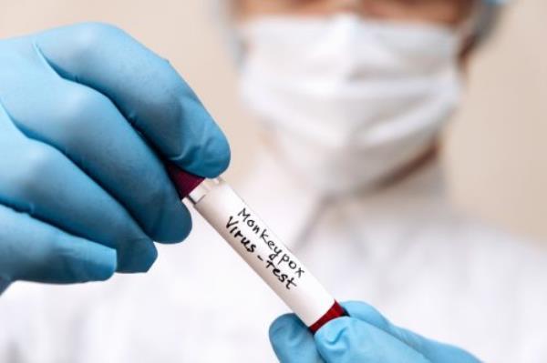 A lab technician holding a blood sample for a mo<em></em>nkeypox test